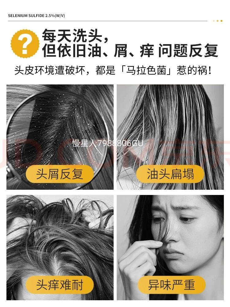 SELSUN�����׶�����2.5%������ϴ��ˮ120ml ��۰� ���ȥм����ֹ���Ż�֤��